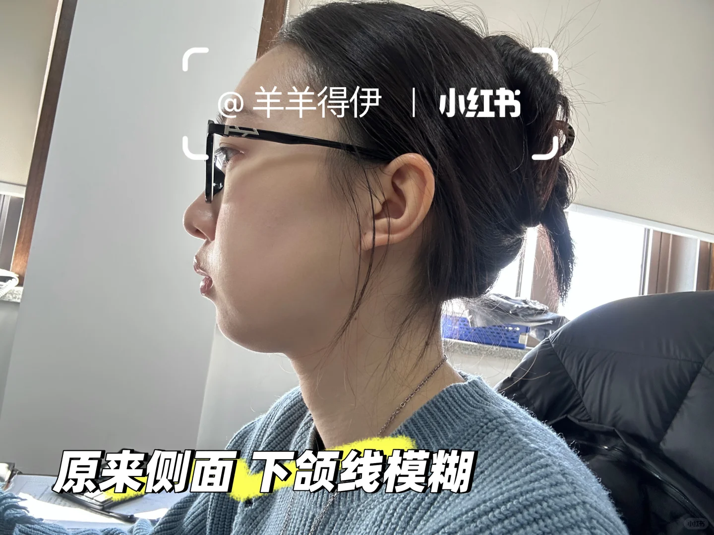 短下巴肉脸一年1w预算如何变美（思路大分享