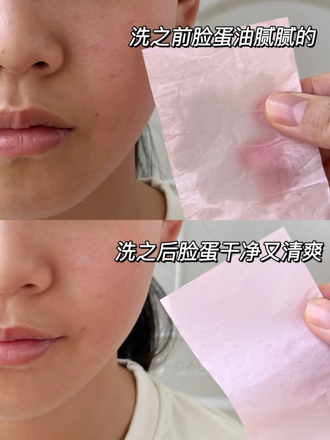 不花冤枉钱❗青春期油痘肌爆改妈生好皮