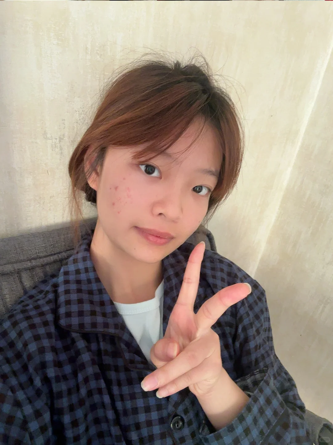 和痘痘和解的第 N 天~
