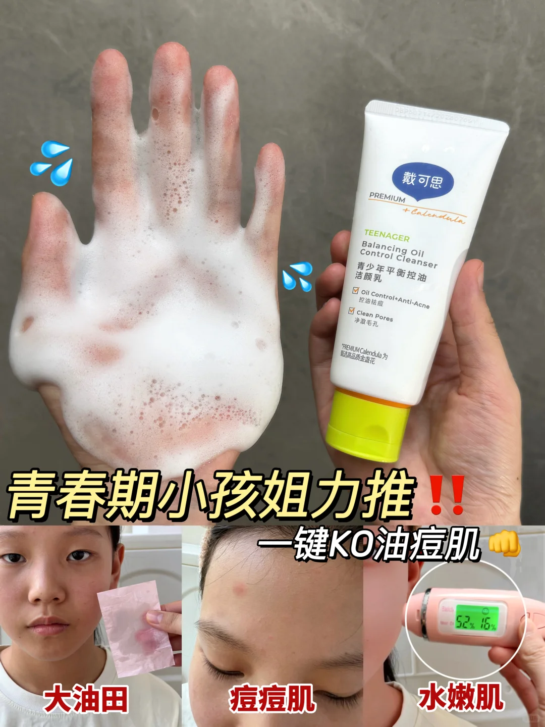 不花冤枉钱❗青春期油痘肌爆改妈生好皮
