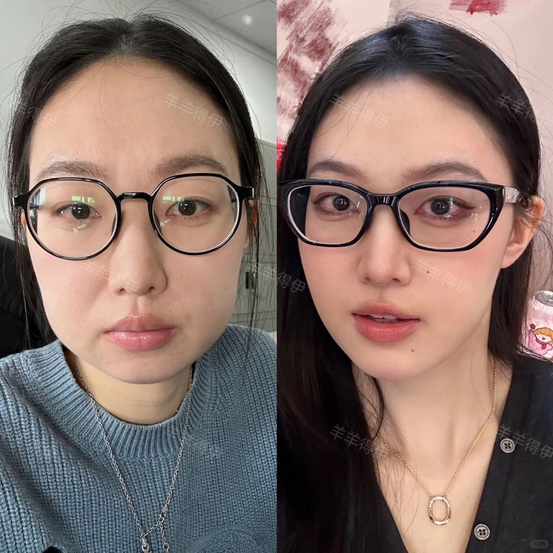 短下巴肉脸一年1w预算如何变美（思路大分享