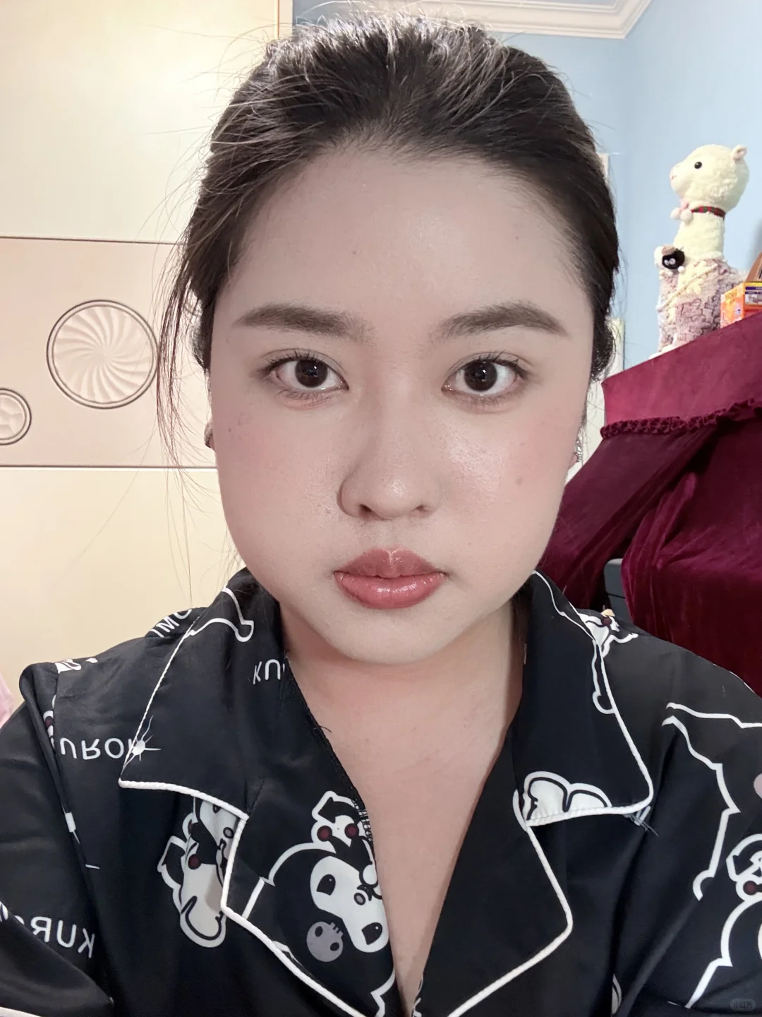 方圆脸瘦脸针三个月前后对比