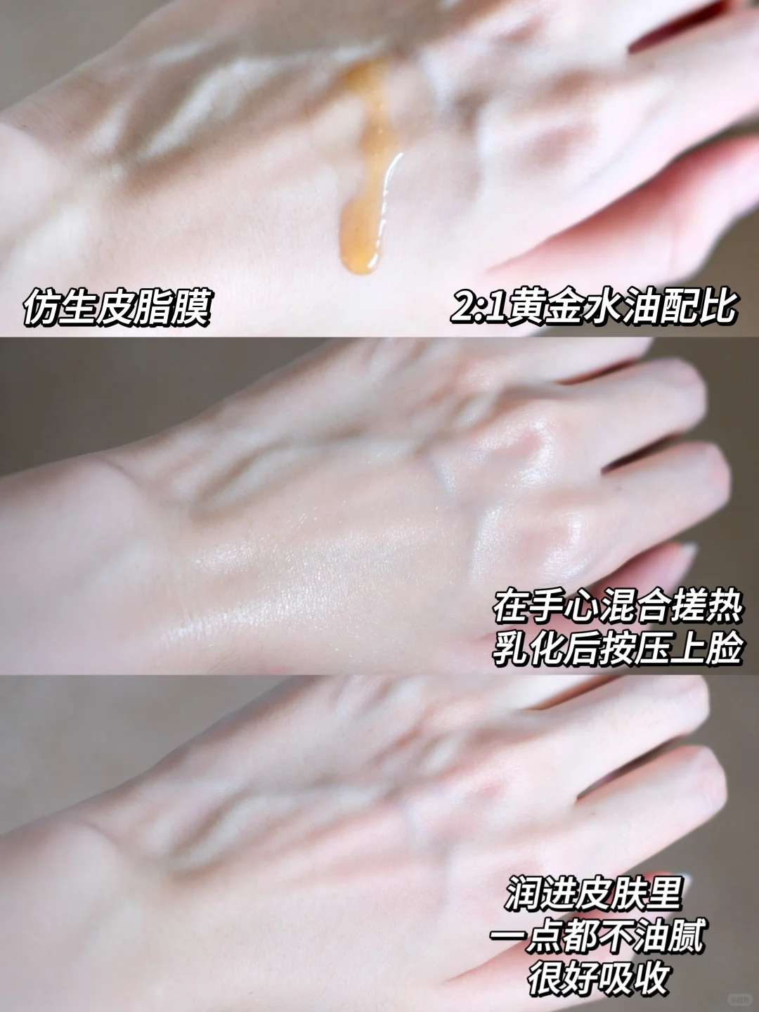 y美信息差！术后精华选对 = 年轻五岁！