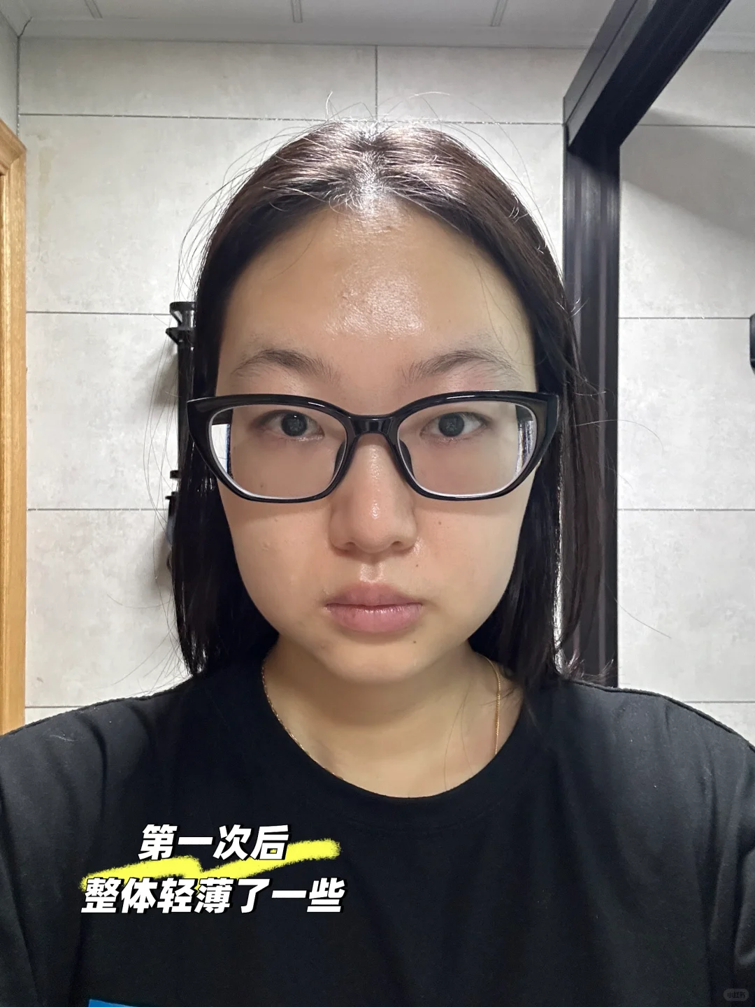 不动🔪爆改轮廓 详讲缩脂🪡对肉肉脸的效果