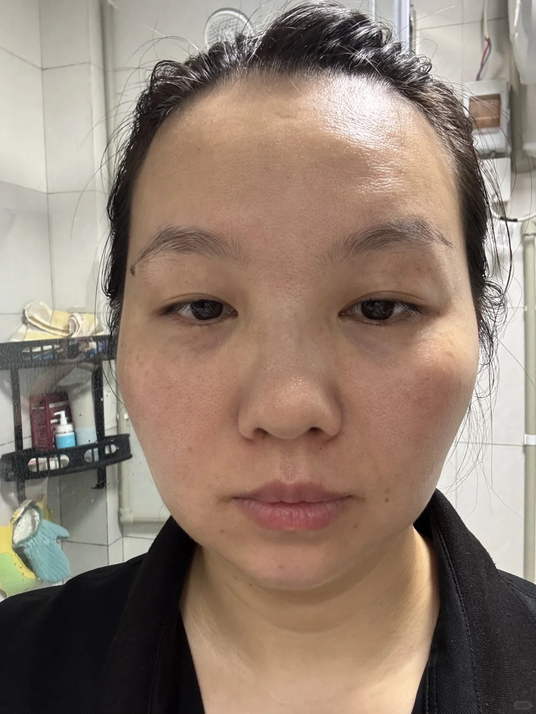 33岁改善法令纹｜撸脸操打卡第一天