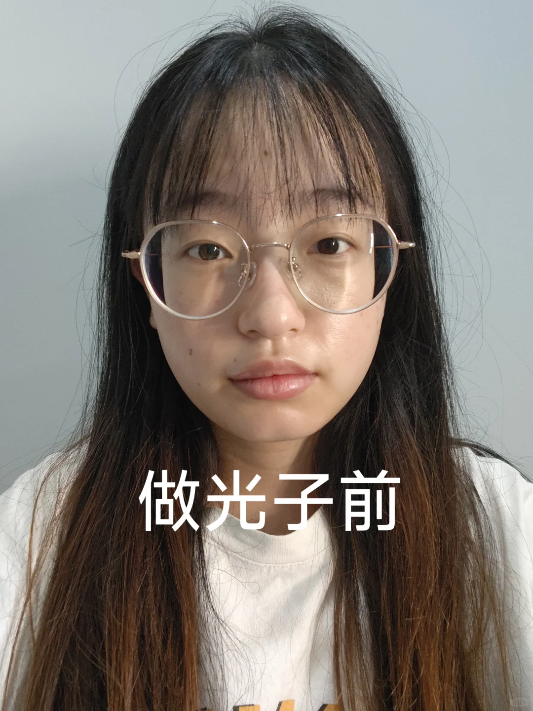 第二次光子前后对比图