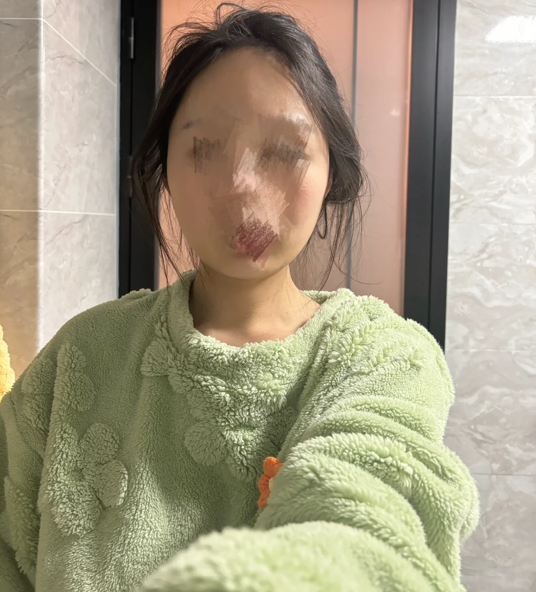 天生瘦脸圣体！💉