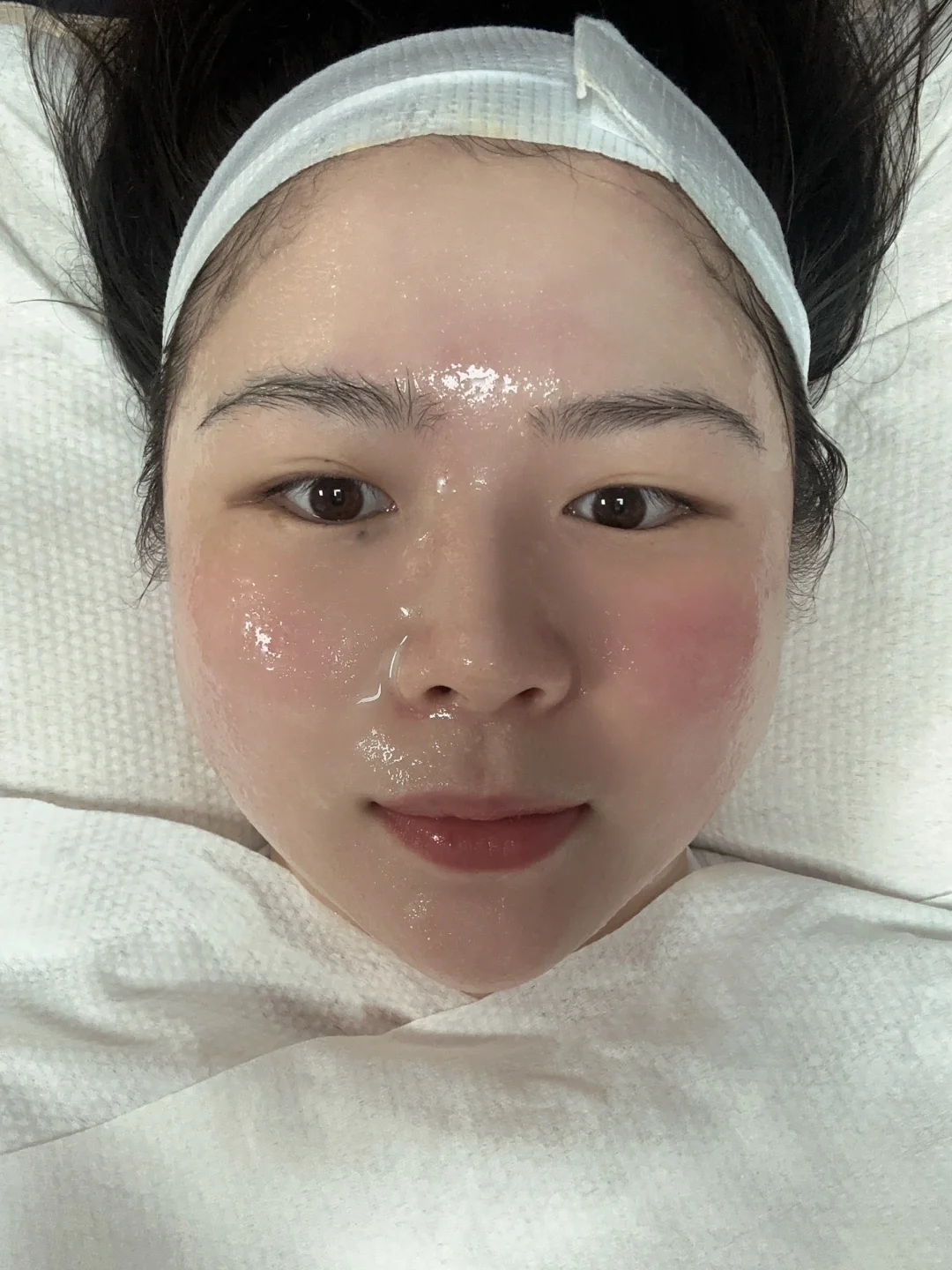 在美容院做了4年的皮肤管理，皮肤真的好吗？