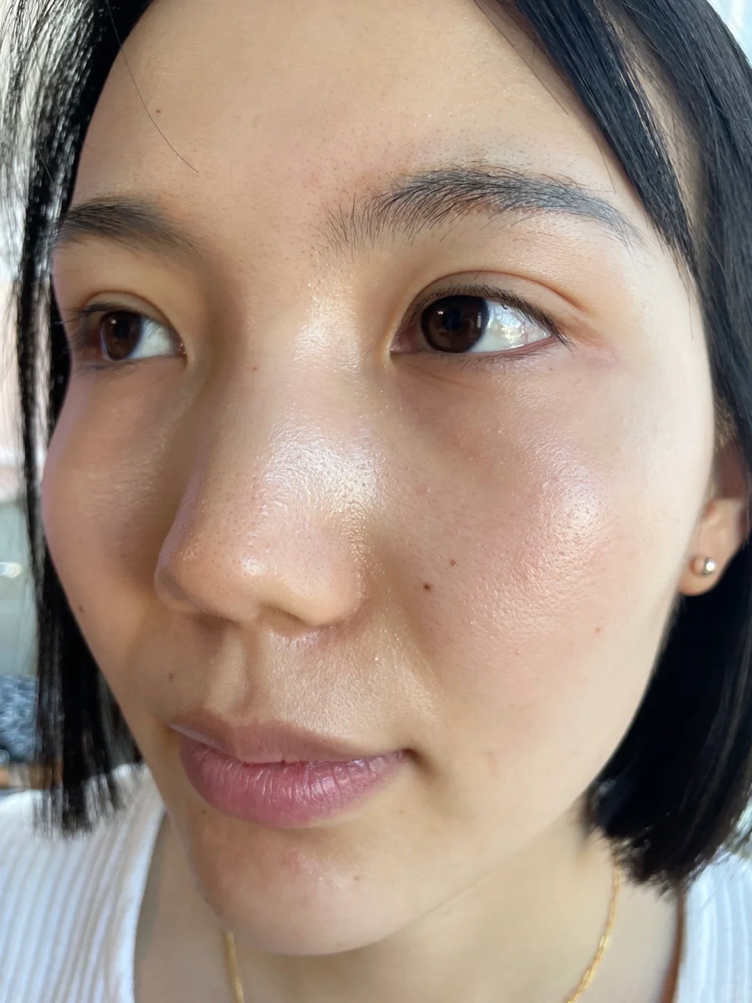 33岁的我，自信回来因为我的大花脸离开了