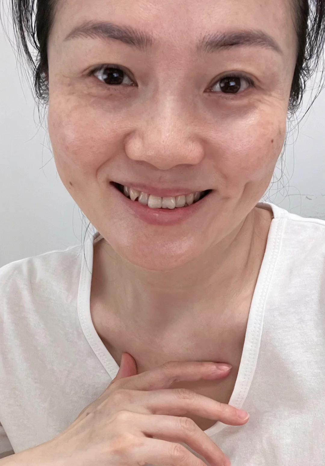 44岁 真实的我🧏‍♀️满脸褶子的我😬😬