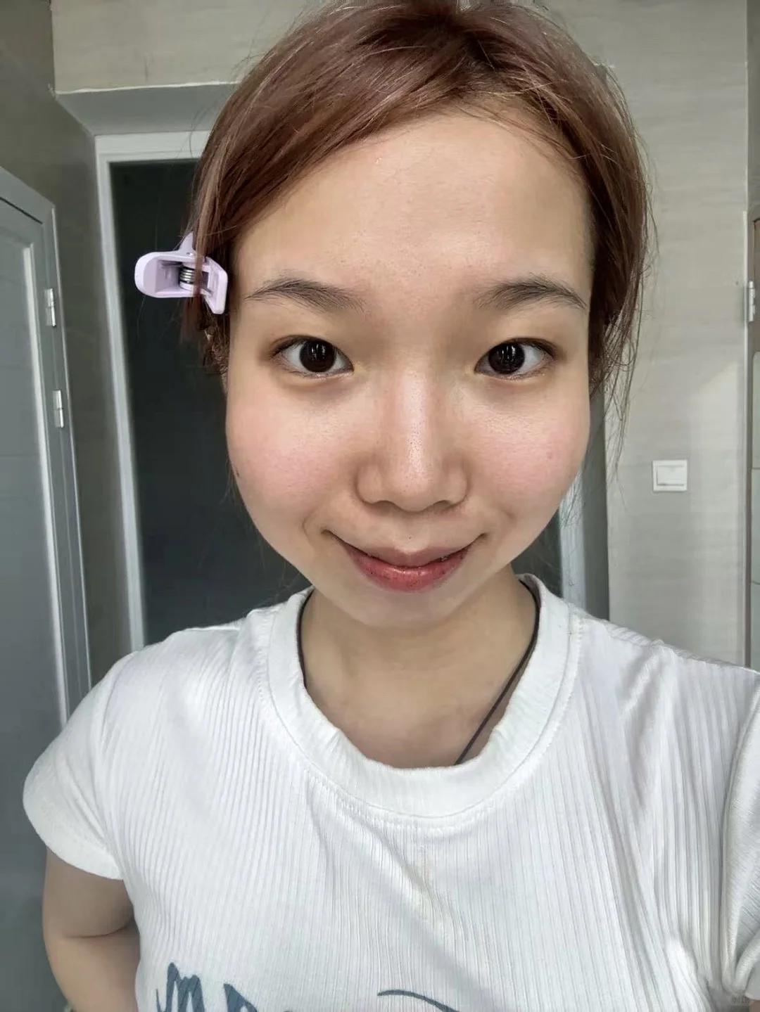 肿泡脸上岸咯 右滑👉