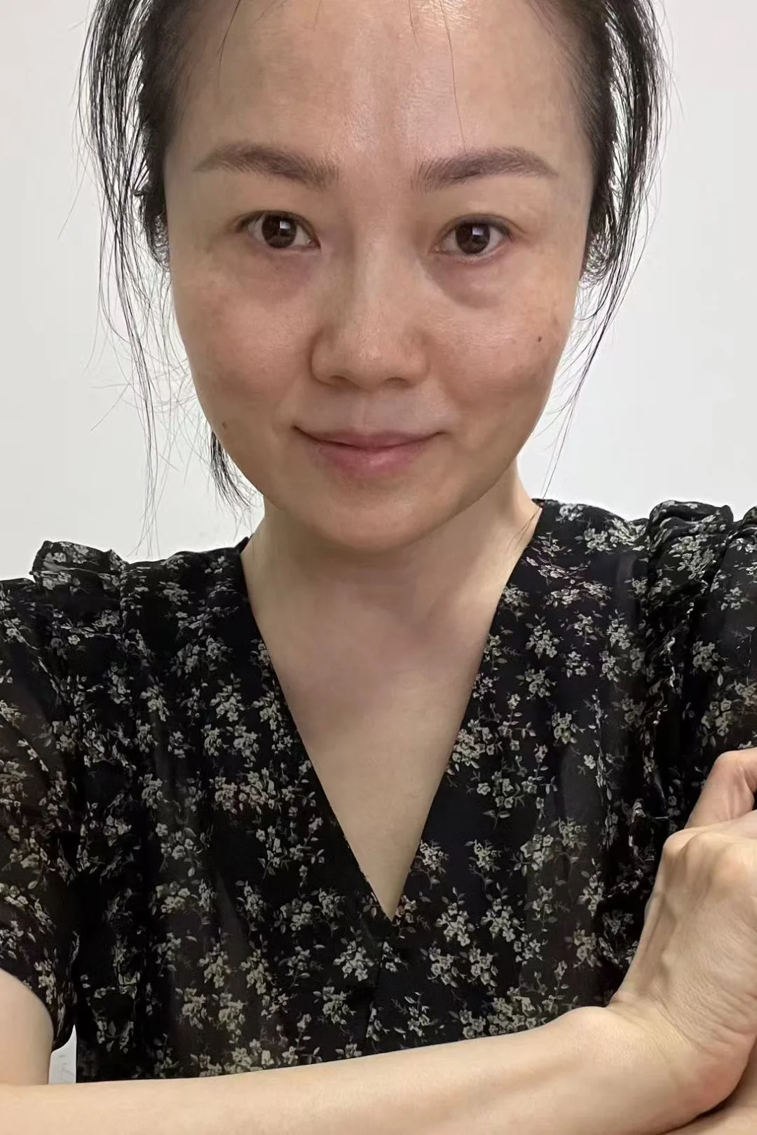 44岁 真实的我🧏‍♀️满脸褶子的我😬😬