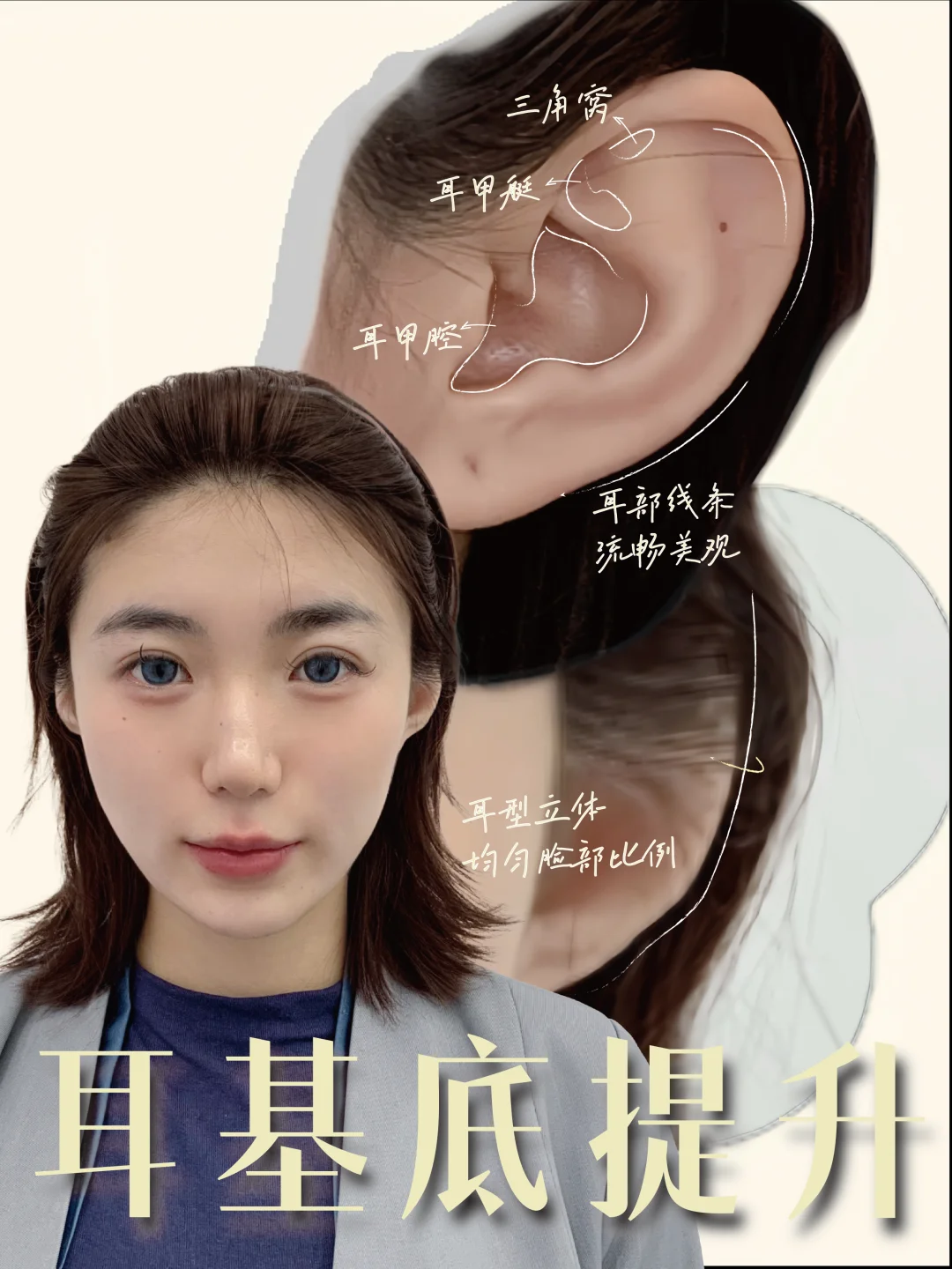 阔面肉肉脸高阶微调🆕三个变美思路