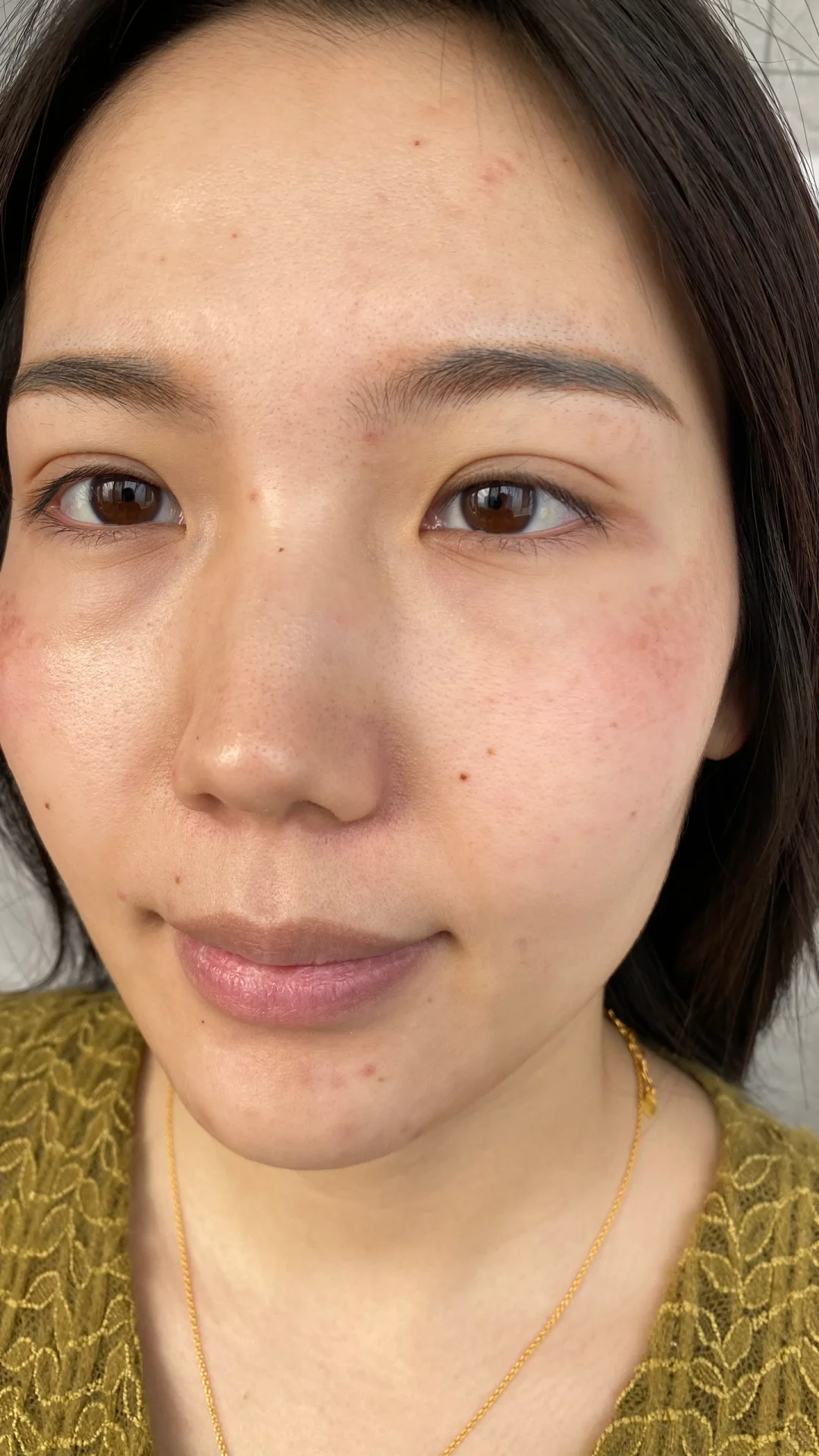 33岁的我，自信回来因为我的大花脸离开了