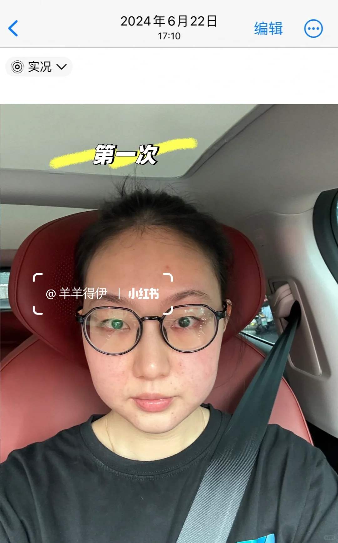 关于我九个月时间做了九次钻石超塑…