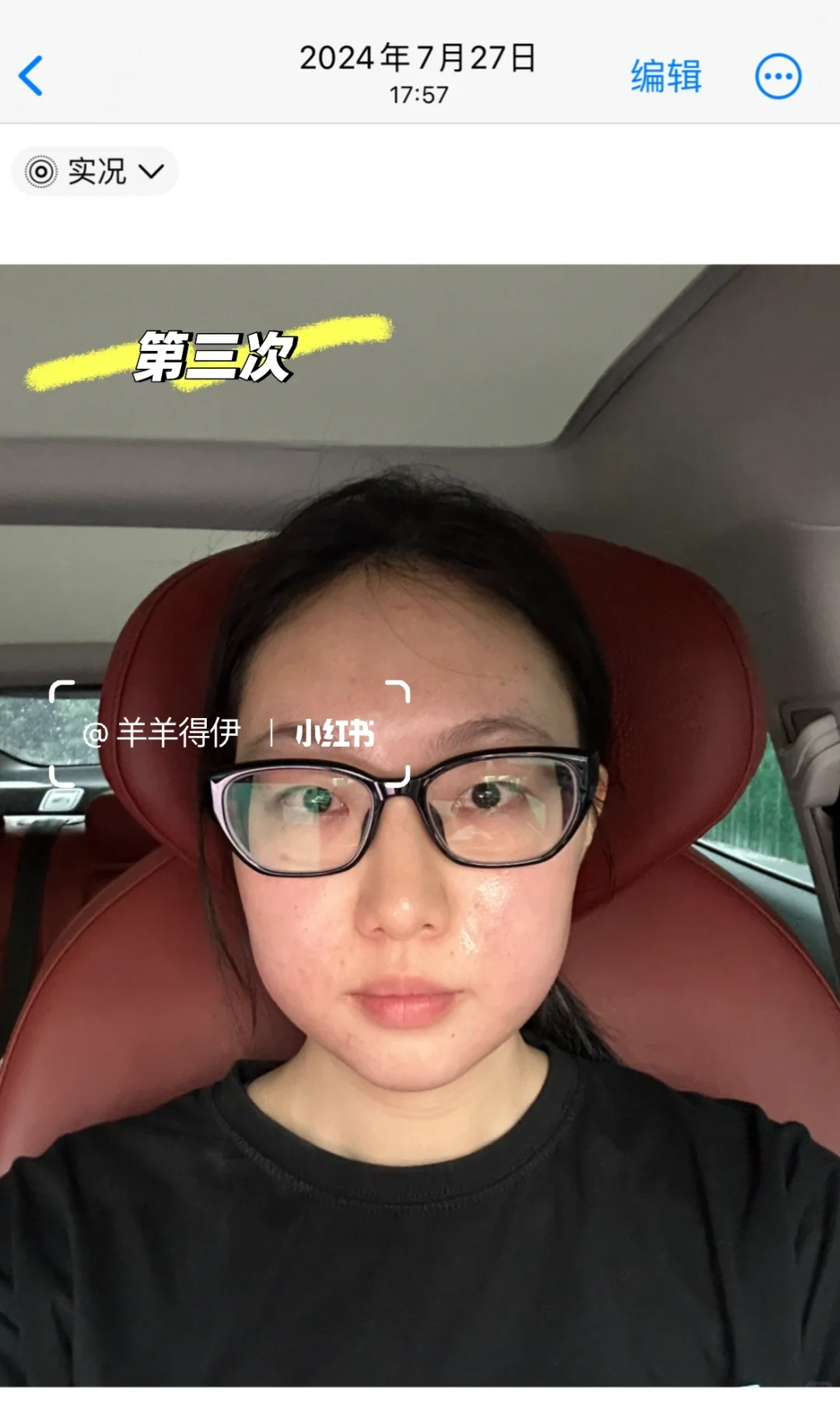 关于我九个月时间做了九次钻石超塑…