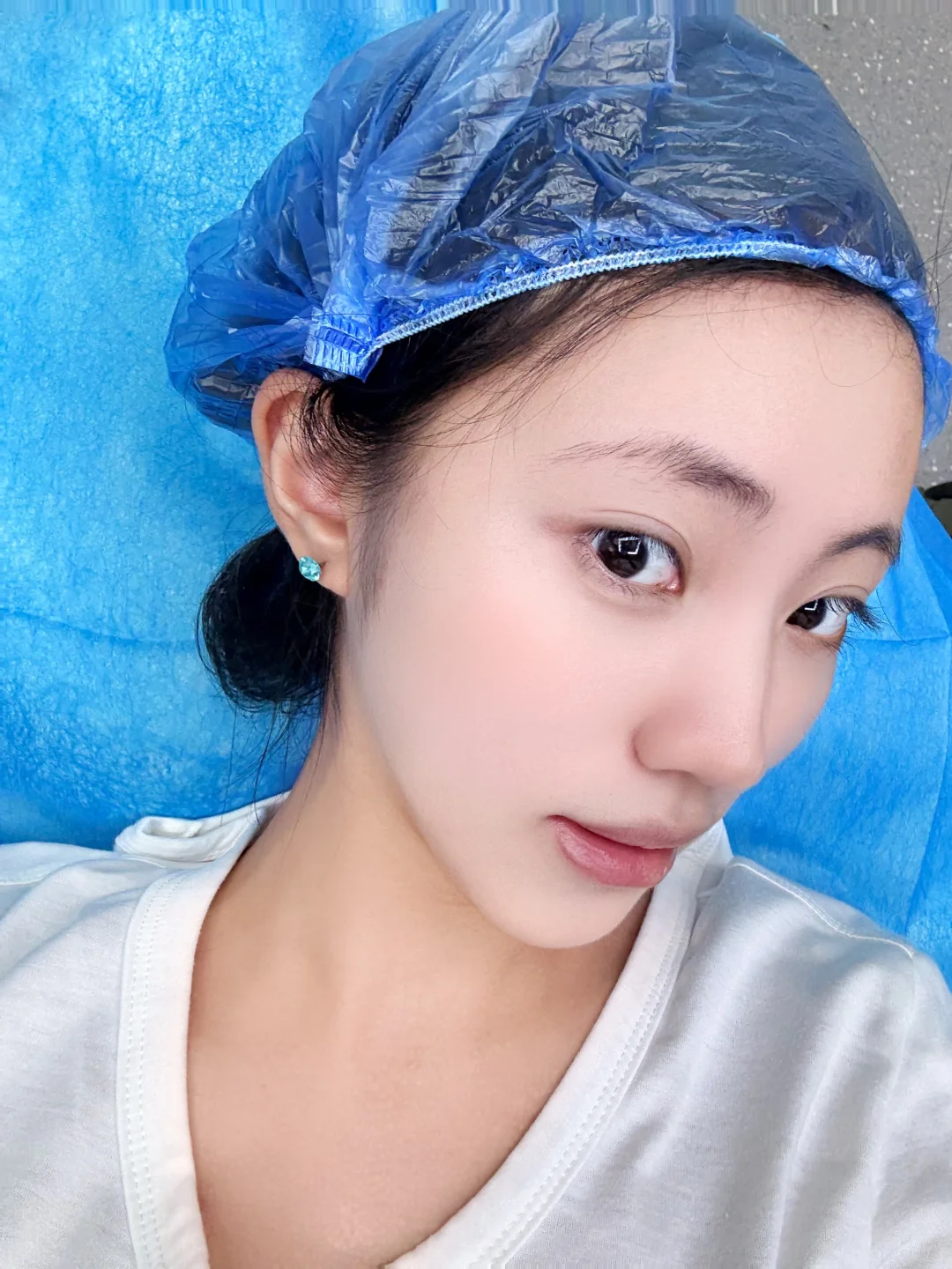 本敏敏肌的无痛抗衰体验🫥