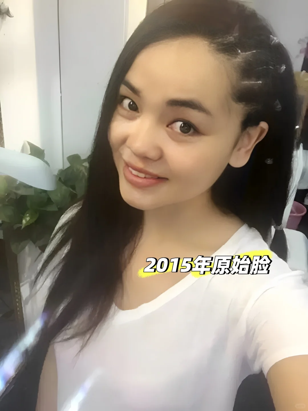 为了变美花了一辆奔驰在脸上8年后怎么样了？