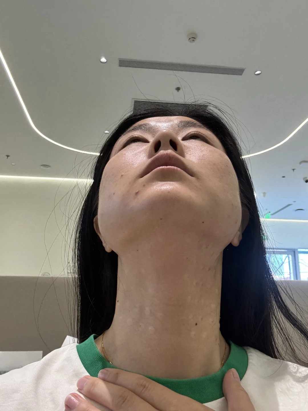 医美的坑一旦入了