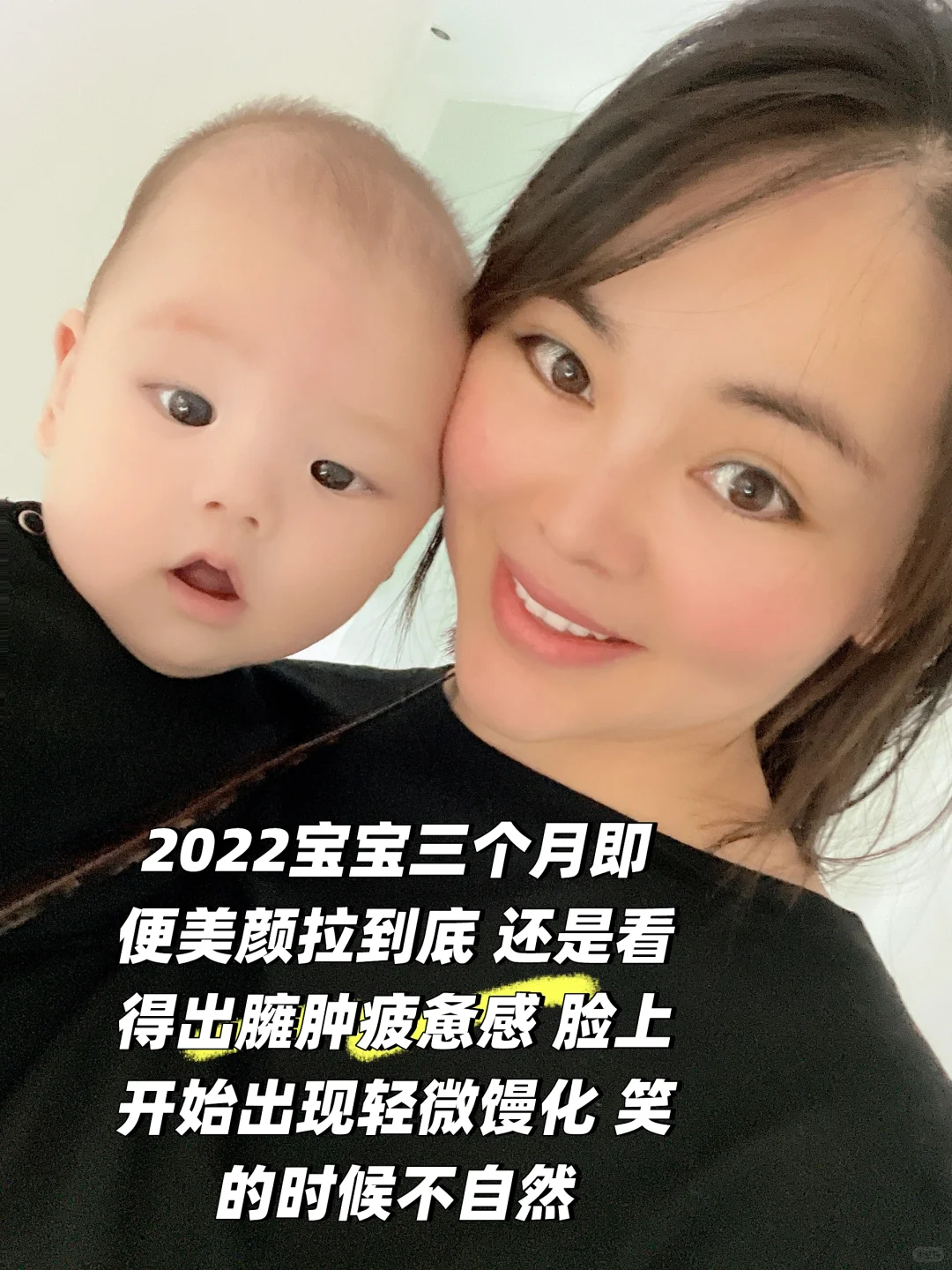 为了变美花了一辆奔驰在脸上8年后怎么样了？