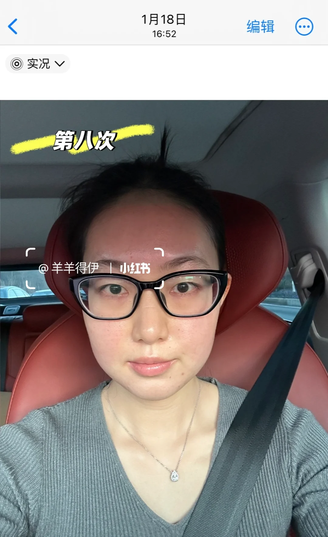 关于我九个月时间做了九次钻石超塑…