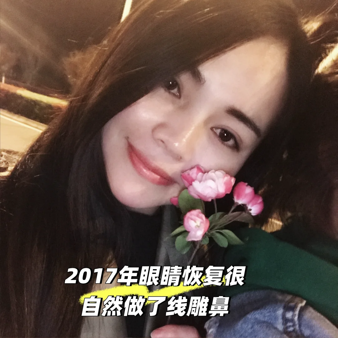 为了变美花了一辆奔驰在脸上8年后怎么样了？