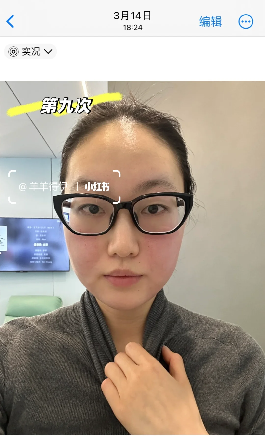 关于我九个月时间做了九次钻石超塑…