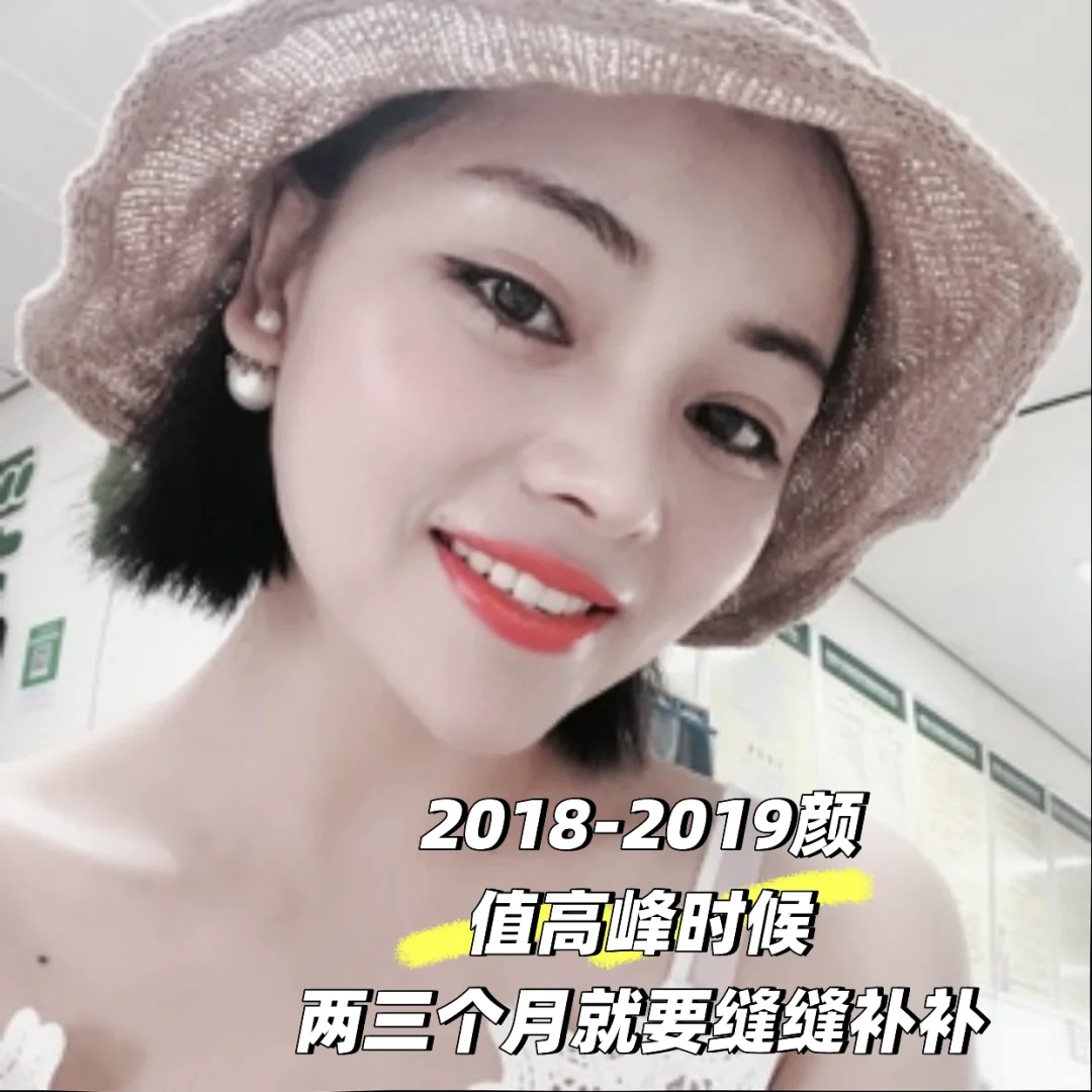 为了变美花了一辆奔驰在脸上8年后怎么样了？