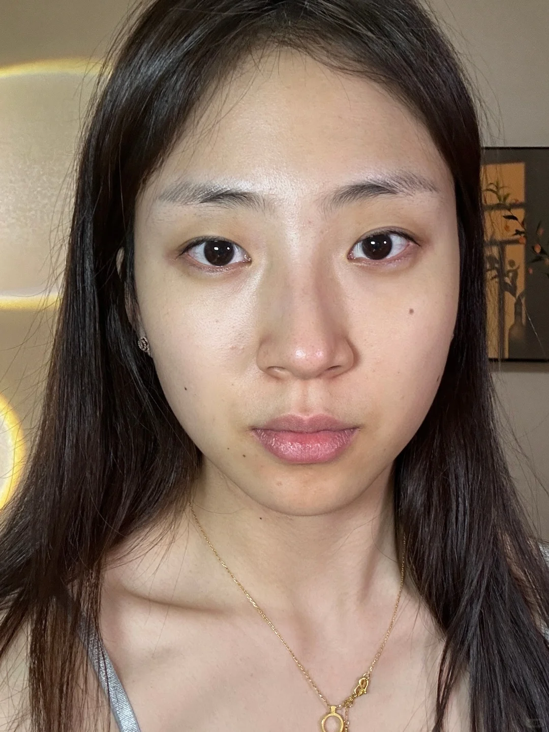 25岁阔面小方脸打瘦脸针