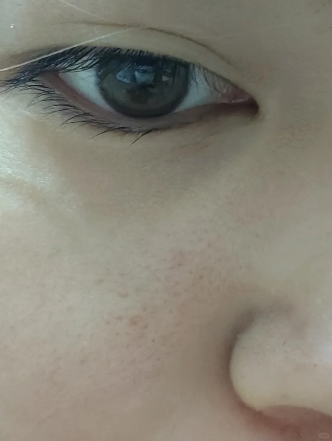 毛孔粗大，感觉自己丑丑的😭😭😭
