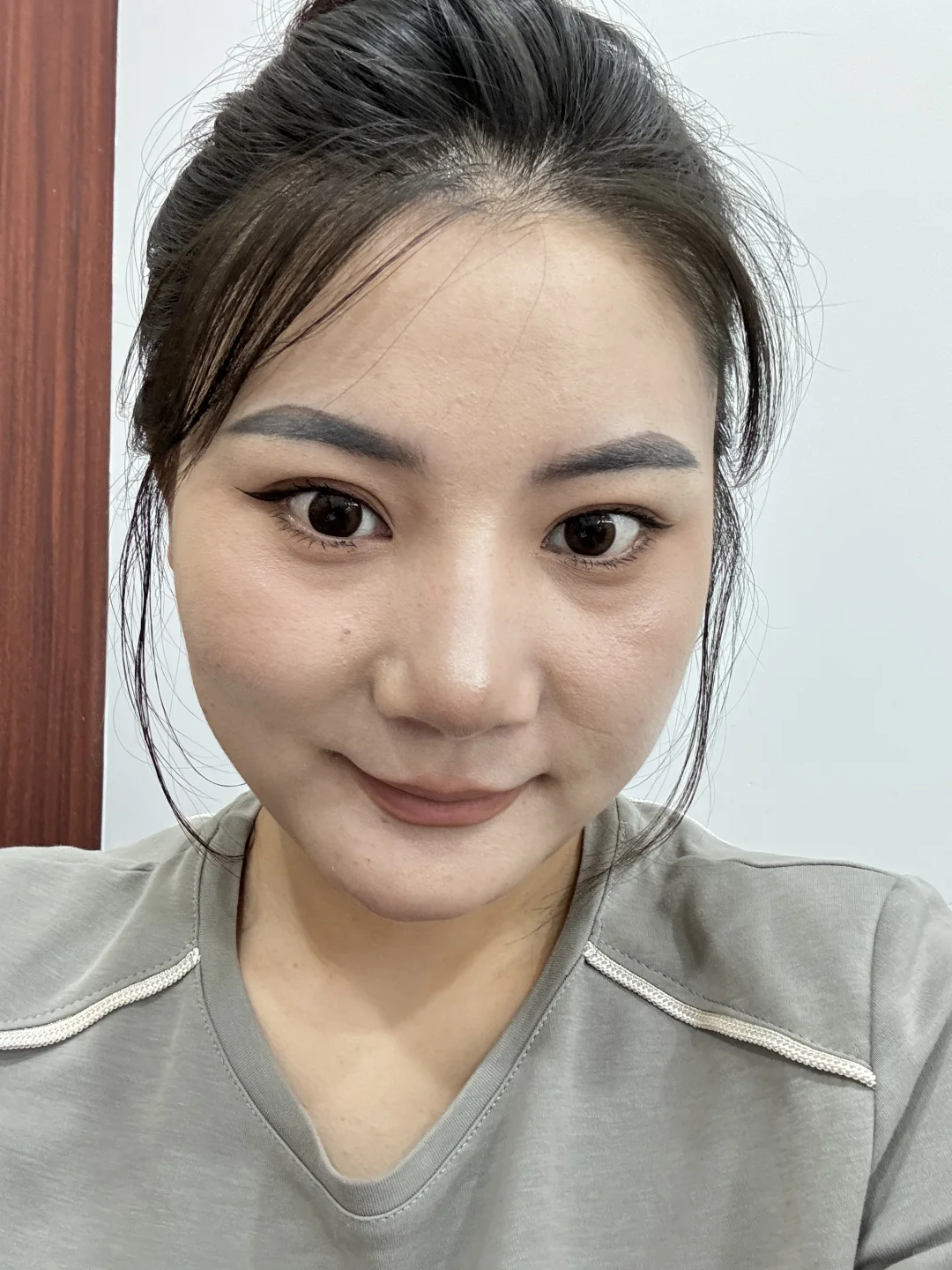 打了瘦脸针后悔了