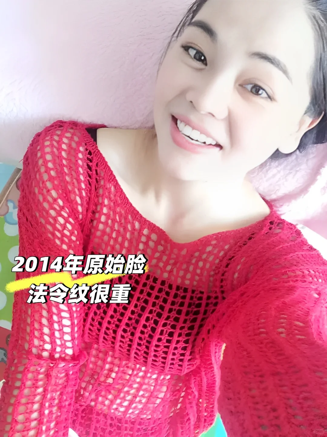 为了变美花了一辆奔驰在脸上8年后怎么样了？