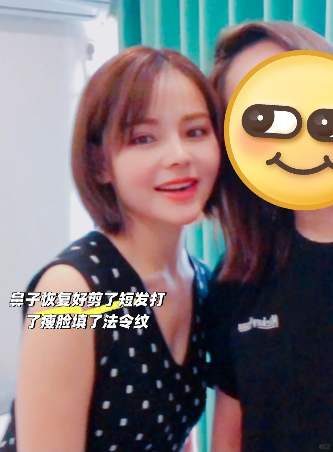 为了变美花了一辆奔驰在脸上8年后怎么样了？
