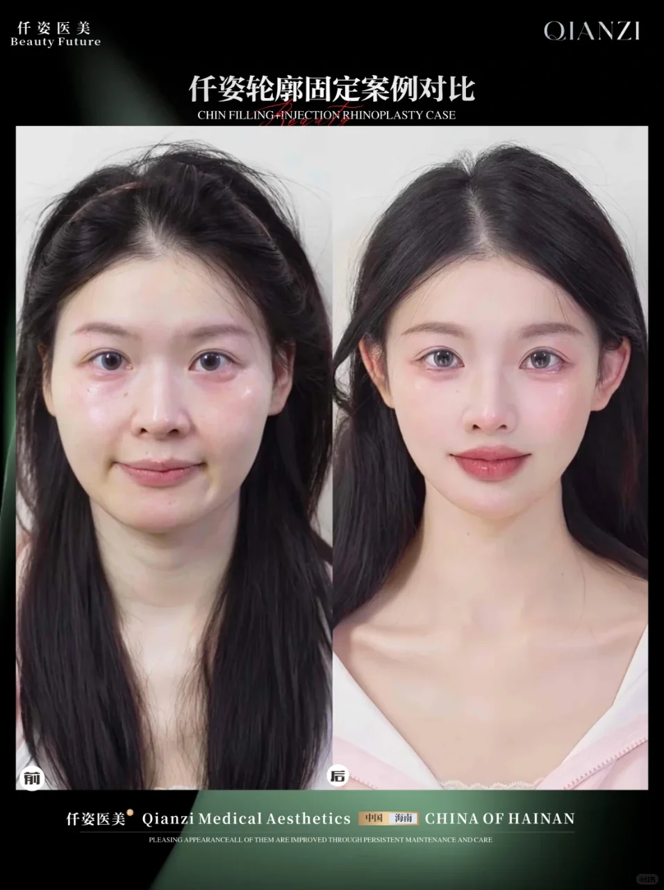 幼态脸🧏🏻‍♀️🧏🏻‍♀️🧏🏻‍♀️