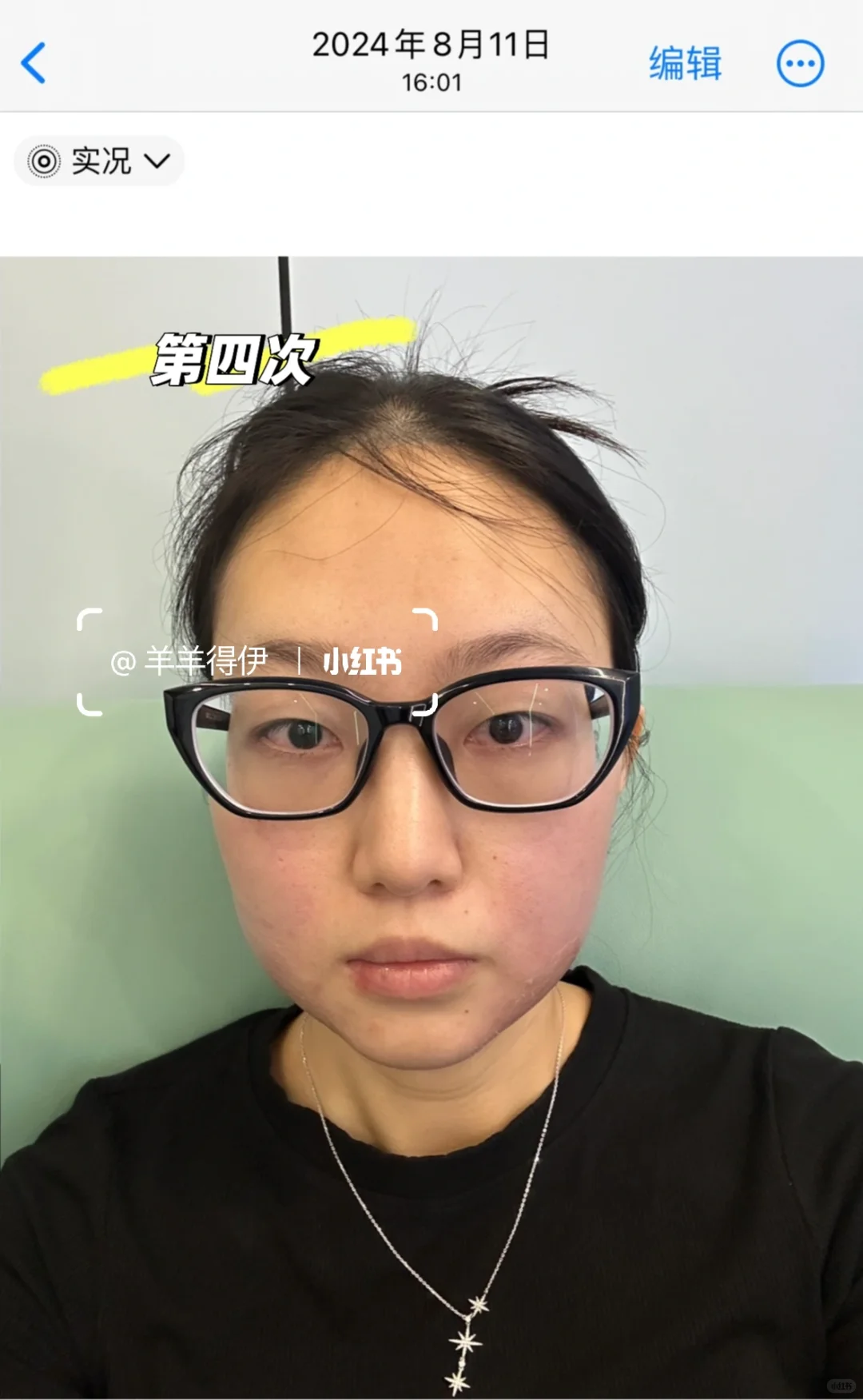 关于我九个月时间做了九次钻石超塑…