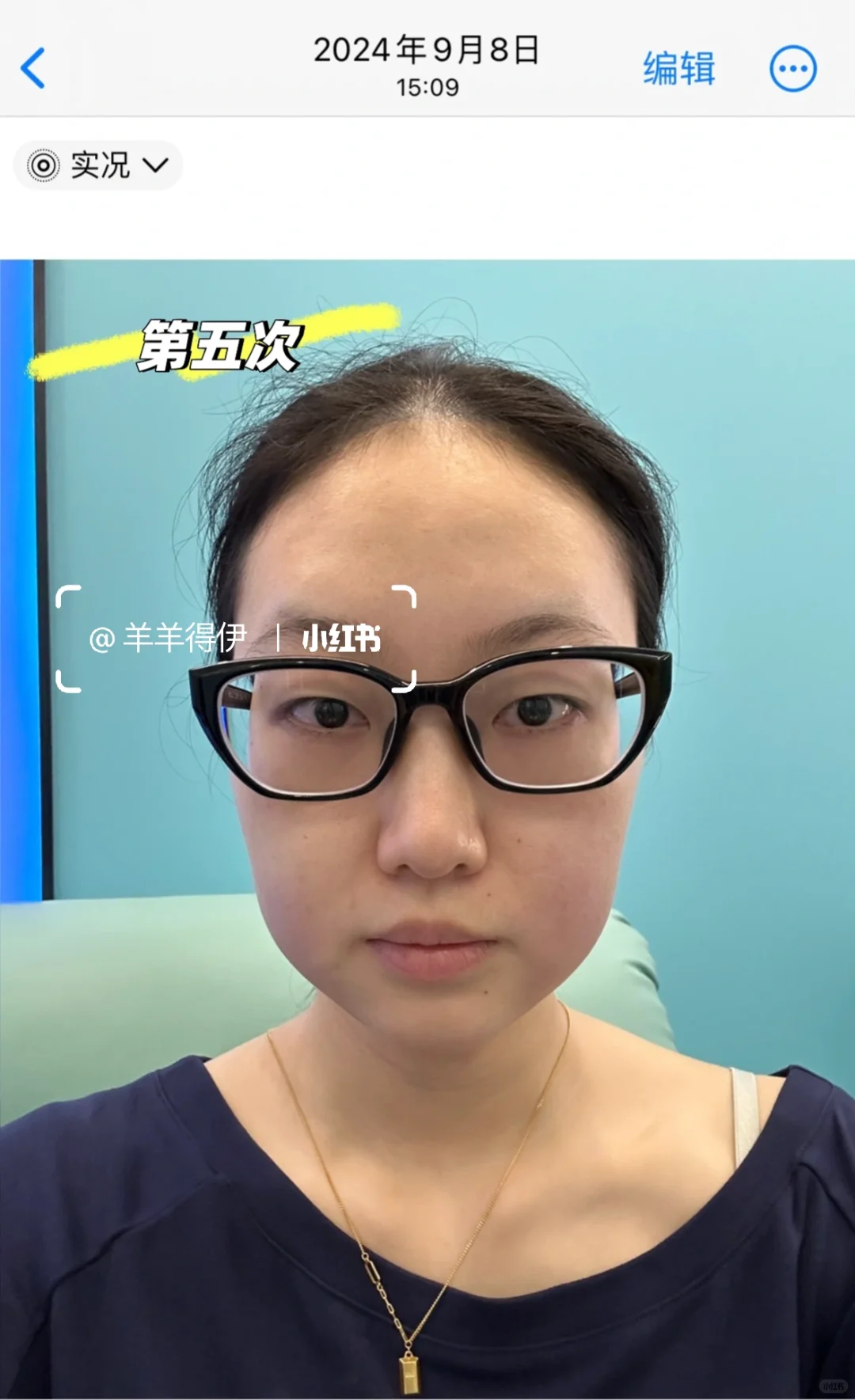关于我九个月时间做了九次钻石超塑…
