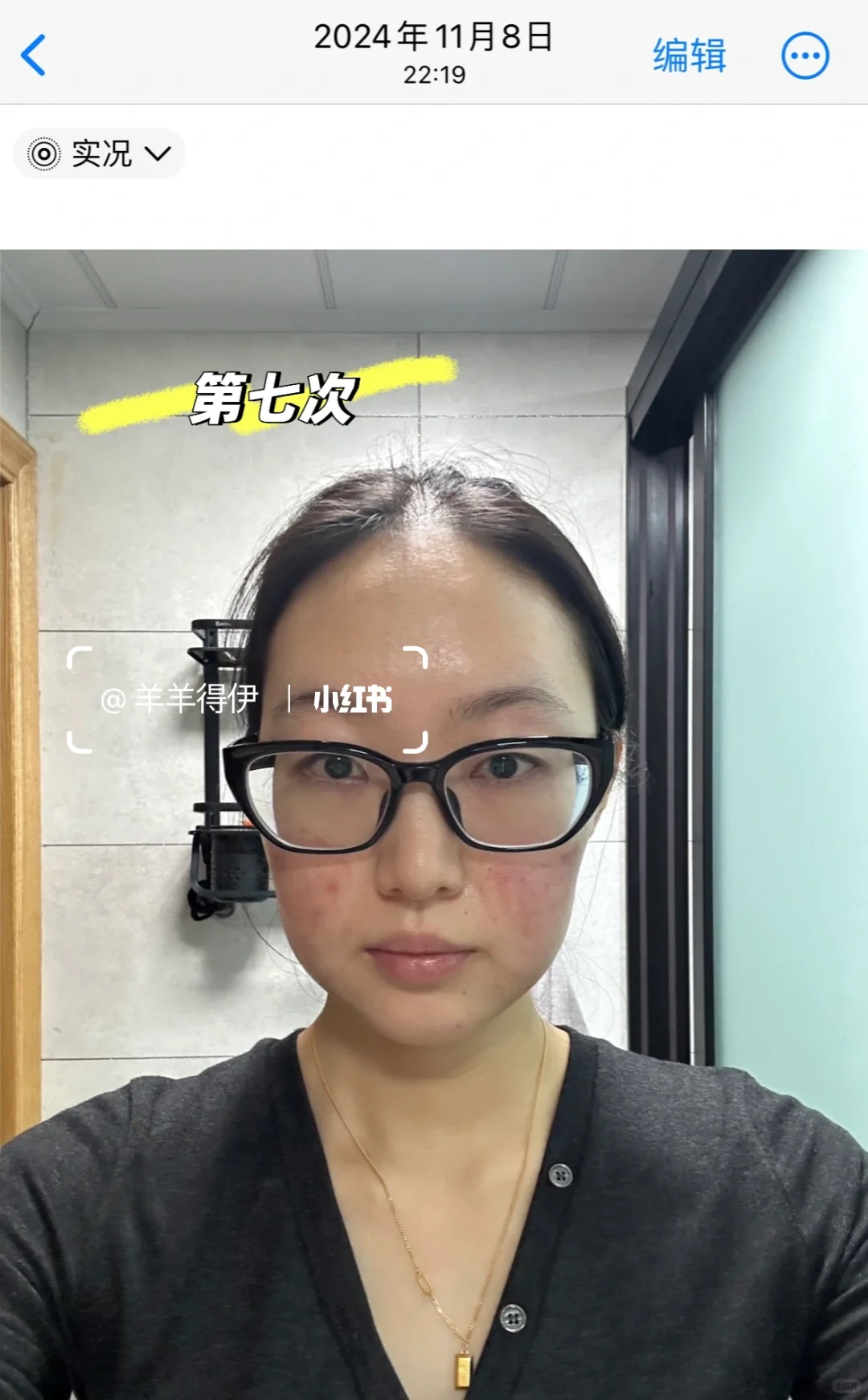 关于我九个月时间做了九次钻石超塑…