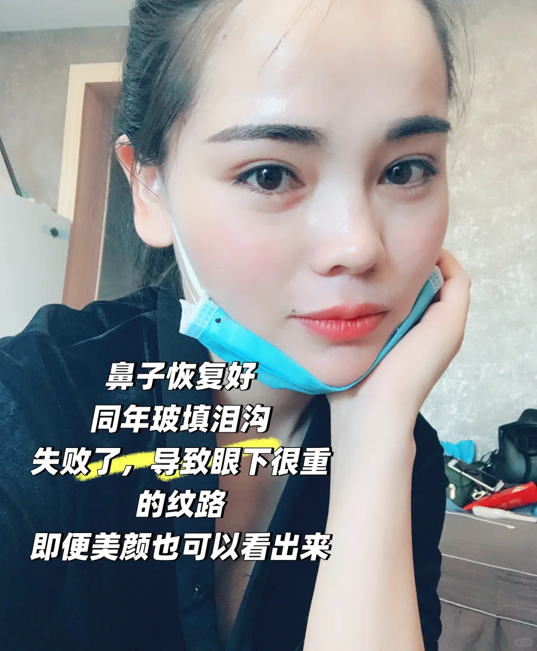 为了变美花了一辆奔驰在脸上8年后怎么样了？