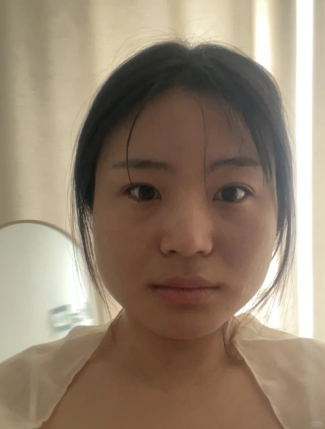 瘦脸针第10天📝