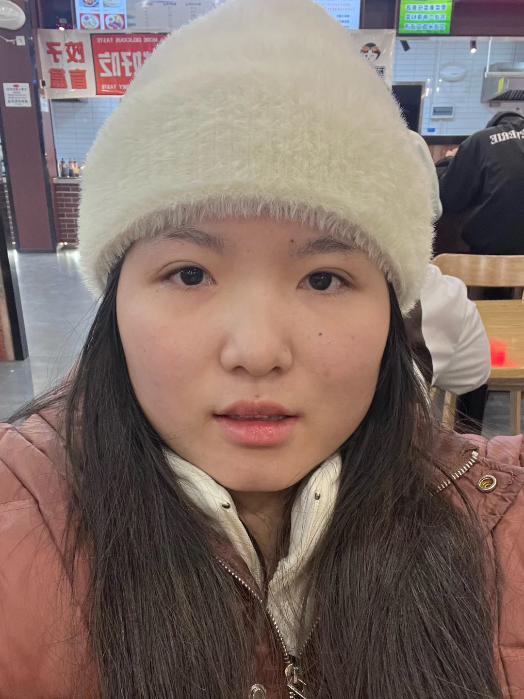 大连瘦脸针100u保妥适打三个部位