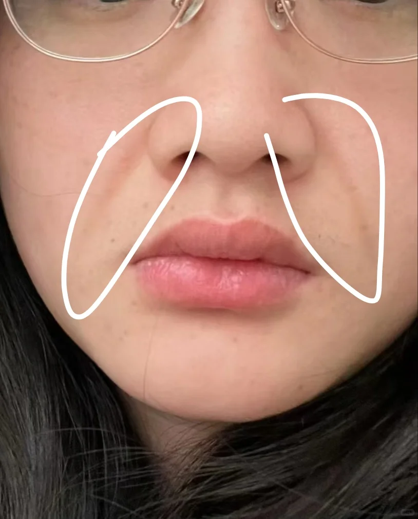 离谱，才二十八这脸就