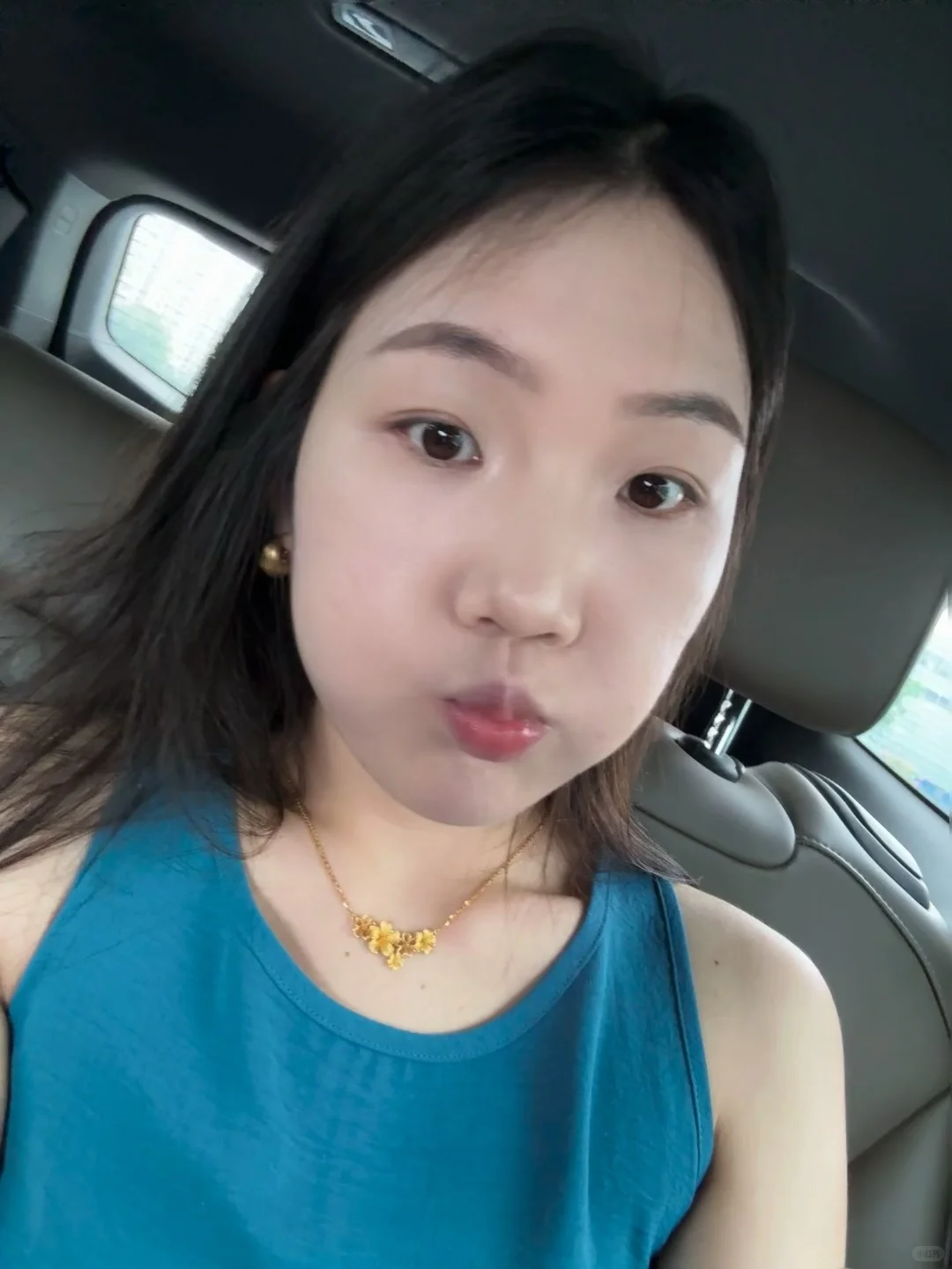 菱形脸+大小脸婚前什么时候打玻尿酸合适啊