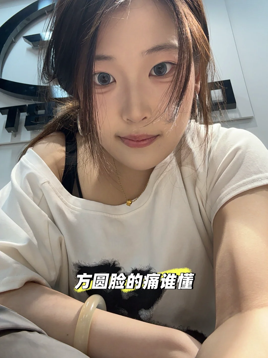 瘦脸+下颌缘提升1⃣个月了