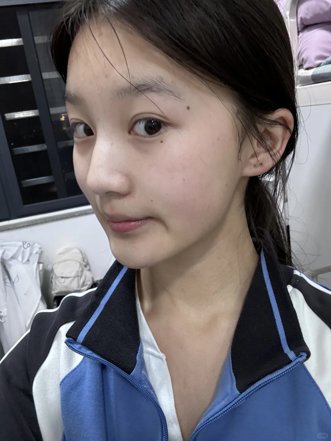我真的要爱上不长痘时候的自己了…