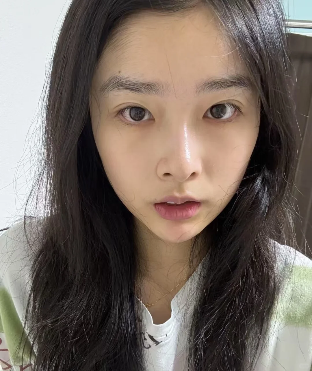 大小脸都来看看，替你们试过瘦脸针了
