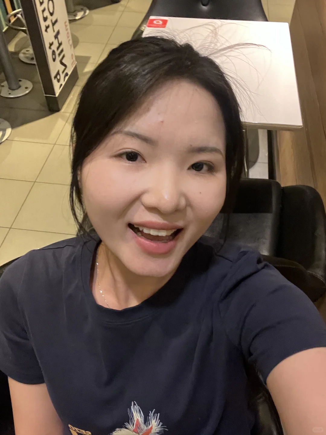 大连瘦脸针100u保妥适打三个部位