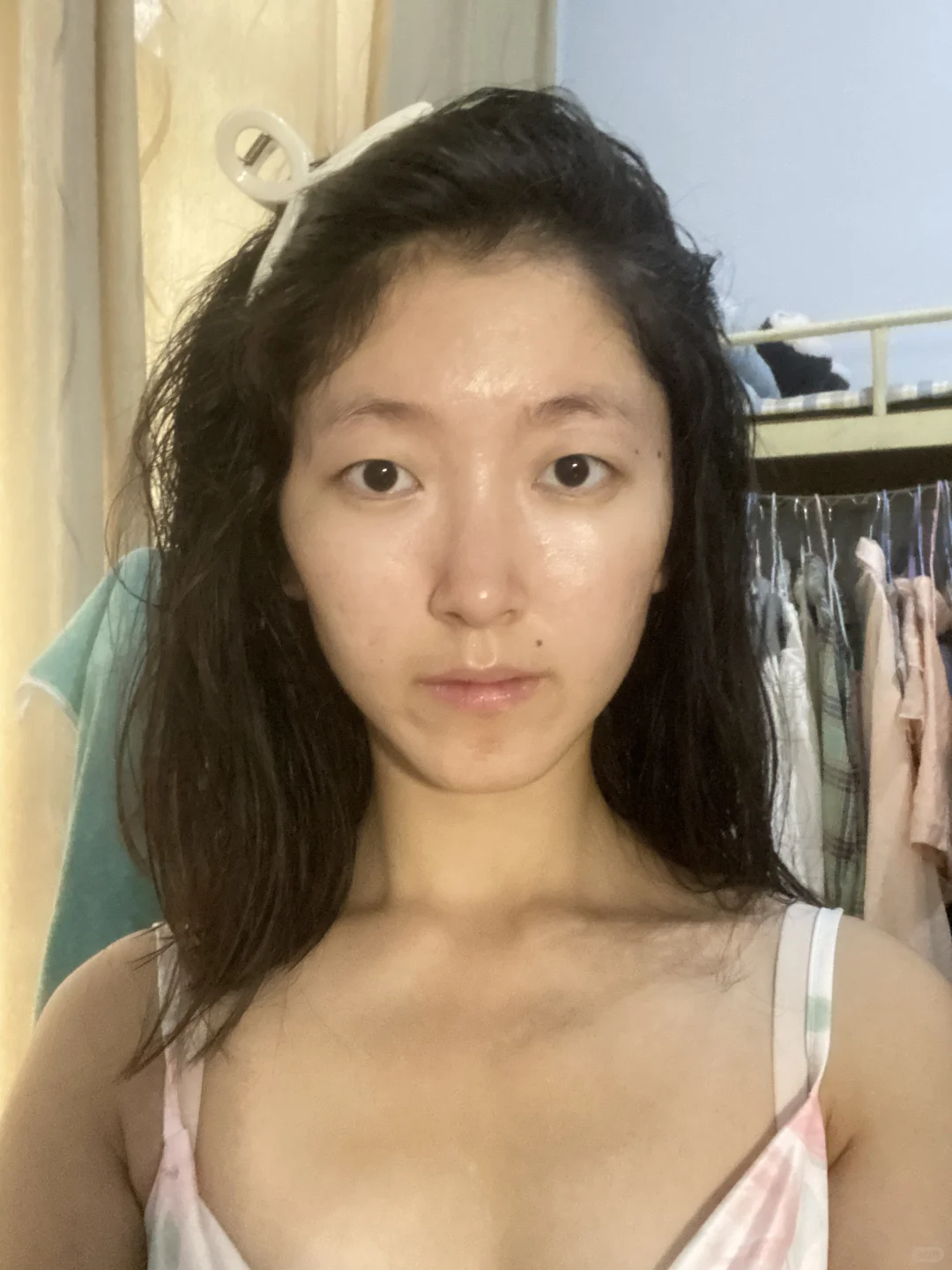 痘肌的痛我懂！左滑看我逆袭