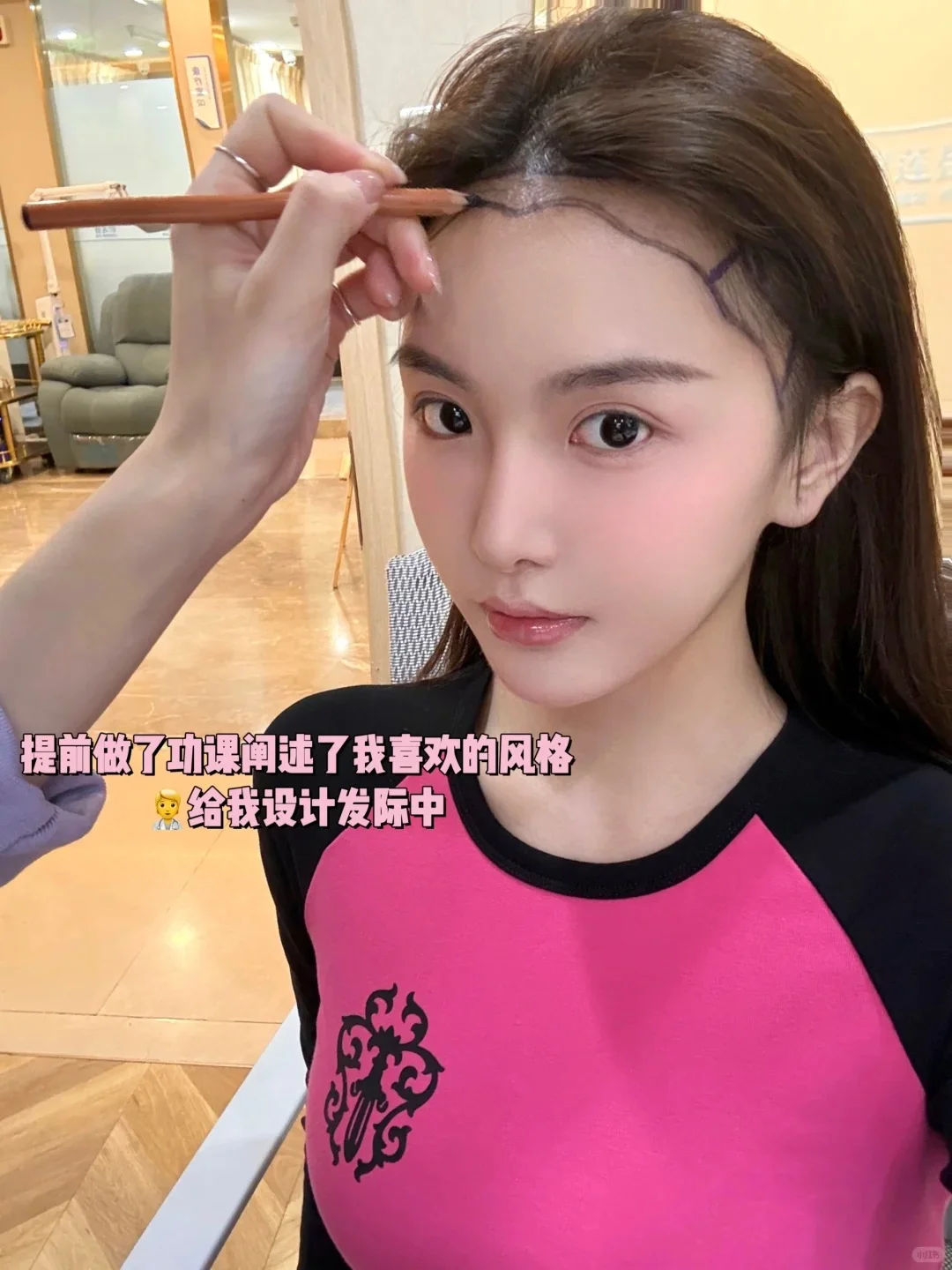 半年植发分享来了，头包脸太美了