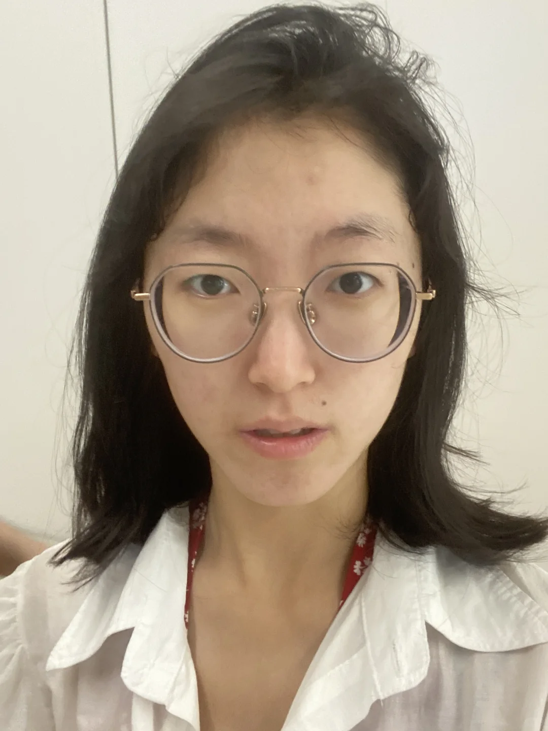 痘肌的痛我懂！左滑看我逆袭
