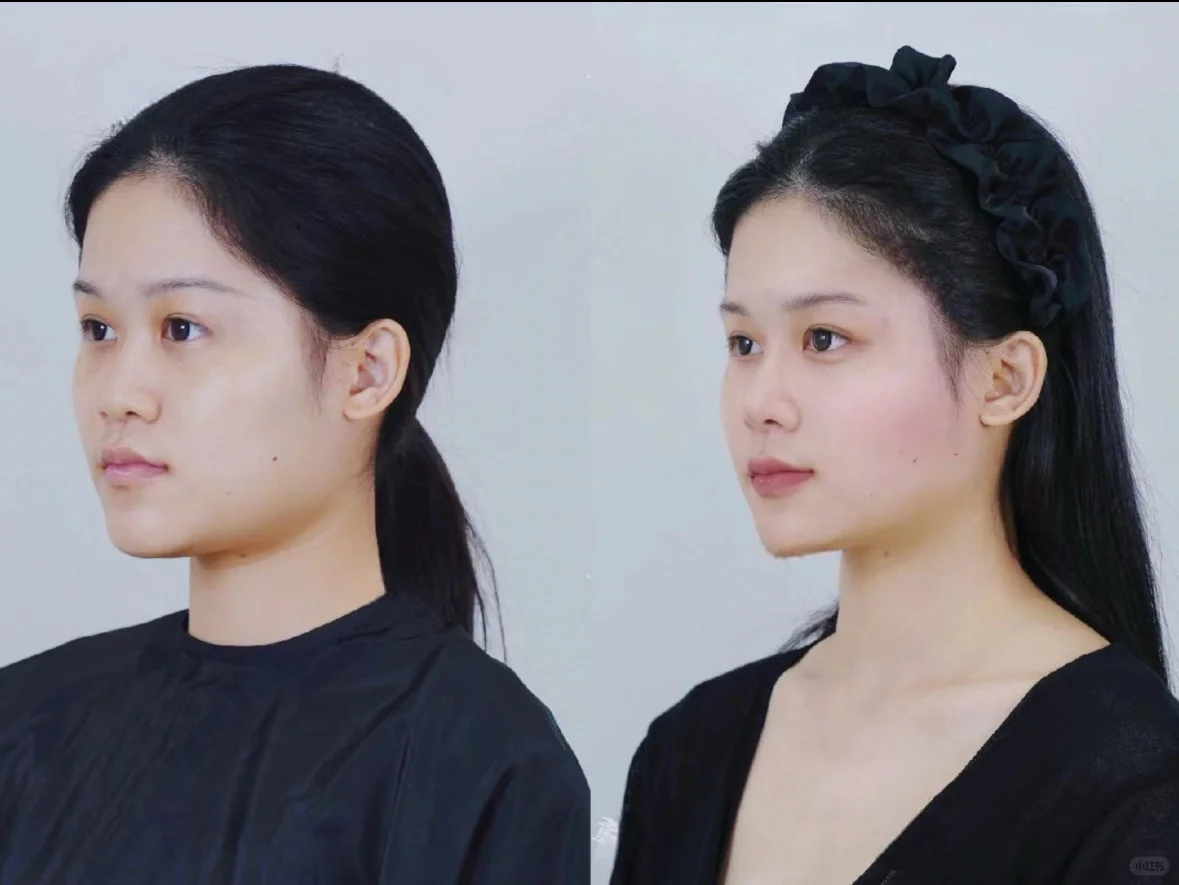 00 后小美今日份 “返厂维修” 打卡！